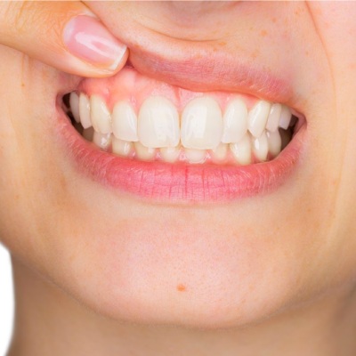 periodontia-01 periodontia