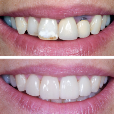 reabilitacao oral reabilitacao oral